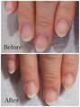 ハナビューティ アシヤ(Hana Beauty Ashiya)&nbsp;健康なお爪に変わっていきます。ご相談下さい