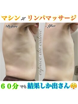 カルマーアンドビー(Calmer & Be.)/【メンズ痩身】Before/After