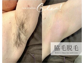 ワックスサロン ジー(waxsalon Gee!)/【脇×脱毛】