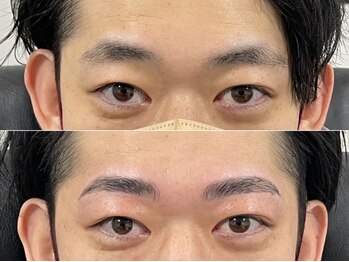 まゆはだの写真/WAX脱毛が最適♪【基本の眉コース¥4980】高い技術力でモチ抜群★モニター様には次回オプションプレゼント♪