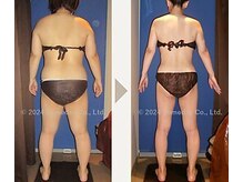 【9か月間の結果】体重▲20.3kg 体脂肪▲17.1%　ウエスト▲18.4cm