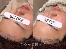 ケアズ(CARES)/透明感アップ！