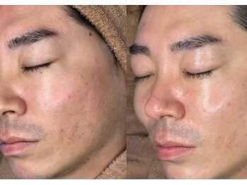 ノア(NOA.)/【MEN'SもOK！ララピール】