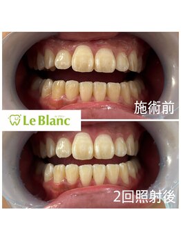 ルブラン 奈良店(Le Blanc)/清潔感アップ！！