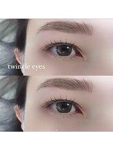 トゥインクルアイズ(twincle eyes)
