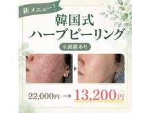 エレナ(Elena)の雰囲気（新メニュー韓国式ハーブピーリング！ニキビ.跡のケアに！）