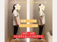 ソルム(solmu)/