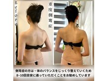 ソウ バイ ソウ(So by 蒼)の雰囲気（一般的な整体や機器では解決できない側湾の方へ。『駆け込み寺』）