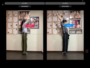 ナオル整体 浅草院(NAORU整体)/30代女性【肩こり・頭痛】