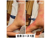 スピード美人 本八幡店の雰囲気（痩せにくい二の腕も1回流すだけでこんなにスッキリ）