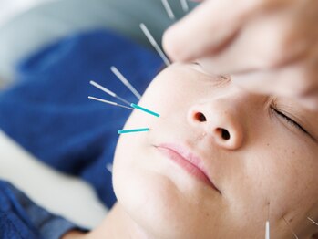 フラット柏(FLAT柏)/改善しないお悩みには鍼灸を…