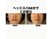 サロン インプルーブ(Salon Improve)の雰囲気（表情も和らぐヘッドスパ♪）