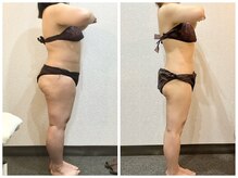 美容整体ウェリナ あま甚目寺院/小顔矯正/骨盤矯正/美脚サロン