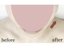 ガーデン(Garden)/滋賀彦根/たるみ改善専門Garden