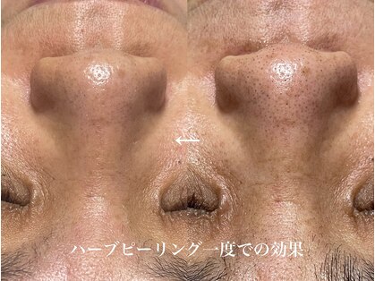 ブリエ(briller)の写真