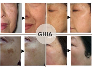 ギア ヘルス(GHIA health)の写真/隠すのはもう終わり！鏡を見るたび気になるシミ・しわに☆今から始める本気の肌ケアで未来の肌まで整える◎
