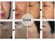 ギア ヘルス(GHIA health)の写真/隠すのはもう終わり！鏡を見るたび気になるシミ・しわに☆今から始める本気の肌ケアで未来の肌まで整える◎