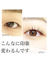 グレイス(grace)/