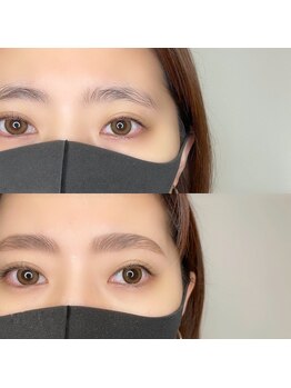 アンドミー(&me)/HBLハリウッドブロウリフト