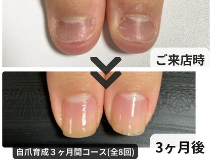 キラーナネイル(KiRANA nail)の写真