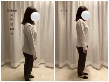 ワン ストレッチ(ONE stretch)/美姿勢20代女性before・after