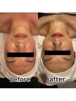 ロカヒ(Lokahi)/ビフォーアフター