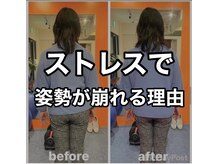 カワル整体 上通り院/ストレスで姿勢が崩れる？