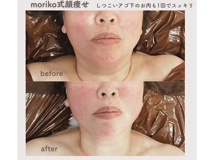 モリコ コンフィデントビューティーサロン(Moriko Confident Beauty Salon)の写真