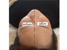 リコット(Licott)/before after写真