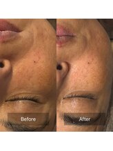 ランファビューティー(蘭花Beauty)/光フェイシャル 《沖縄/宜野湾》