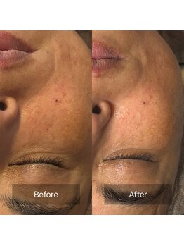 ランファビューティー(蘭花Beauty)/光フェイシャル 《沖縄/宜野湾》