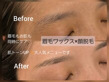 ルフ エステティック ビューティー(ruf esthetic beauty)の雰囲気(大人気の組み合わせメニュー♪)