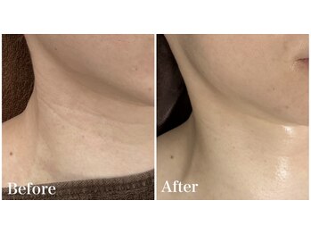 シュ シュ(chou chou)/【セラピールはお首にも】