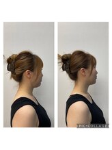 ここから接骨院/15日間で腕マイナス４センチ