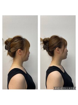 ここから接骨院/15日間で腕マイナス４センチ