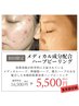 《6月限定》剥離＆痛みの無いハーブピーリング★肌質改善し理想の肌へ￥5500