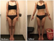 サロンドフェイス(Salon de Faith)/【ラジオ波痩身】6回施術♪