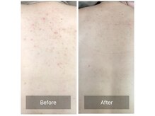 素肌研究所BSラボの雰囲気（丁寧なカウンセリングでお肌のお悩みを改善◎[ハーブピーリング]）