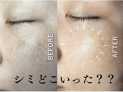 ヒトハダ(hitohada)の写真