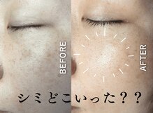 ヒトハダ(hitohada)