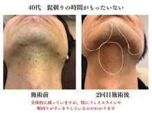 米子エイト/40代