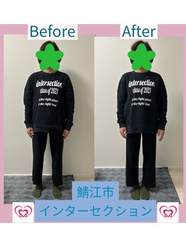 腰の整体インターセクション/【美容整体】ビフォーアフター