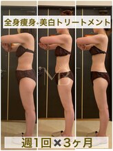 モカフォーブライダル(MOKA FOR BRIDAL)/