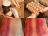 【体内除湿】整体マッサージ30分+かっさ20分+吸い玉カッピング20分70分￥6600