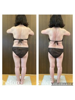 ルミエール(Lumiere.)/美筋シェイプボディ1回目比較