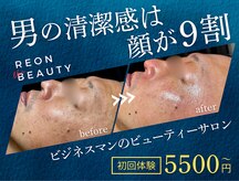レオンザビューティー(REON the BEAUTY)