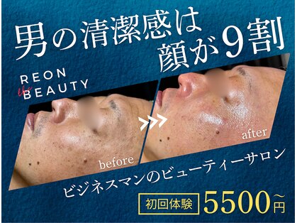 レオンザビューティー(REON the BEAUTY)の写真