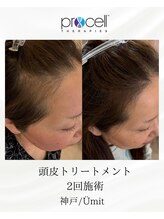 ユミト(Umit)/プロセルスカルプ