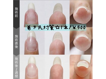 アロハナ(Alohana)の写真