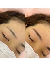 ラ フルール(La Fleur)/ハリウッドブロウリフト